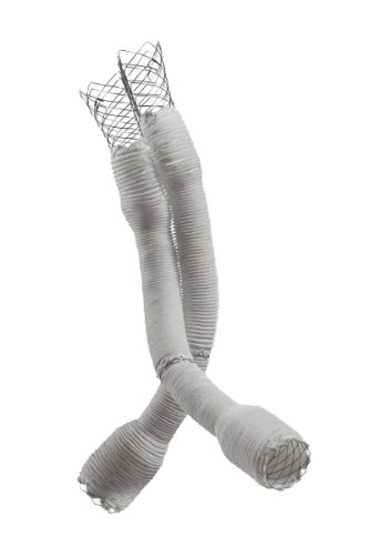 Lombard – Altura™ Endograft System, Aortic Stent Graft 